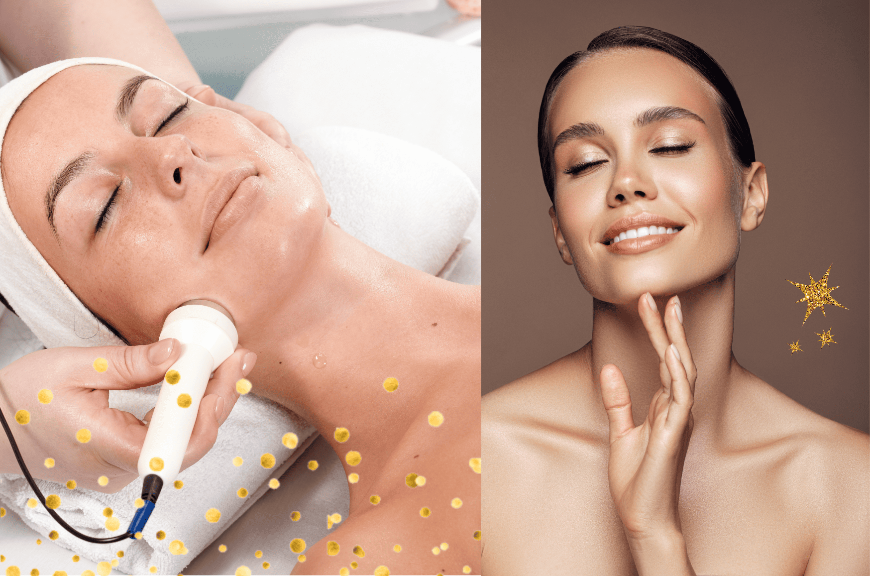 Le soin de Radiofréquence Dermax chez Eden et Sens