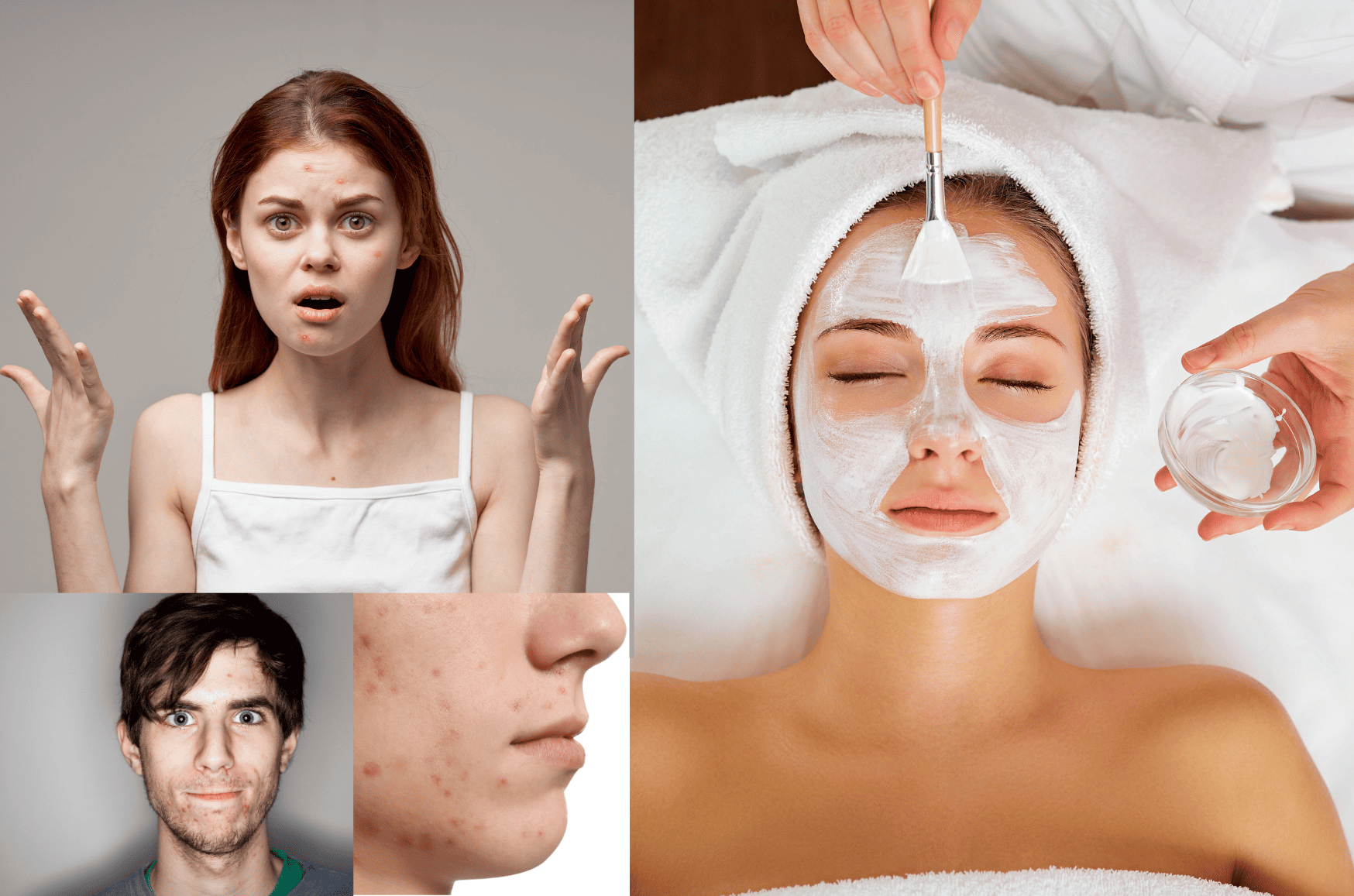 soin antiacné Eden et Sens